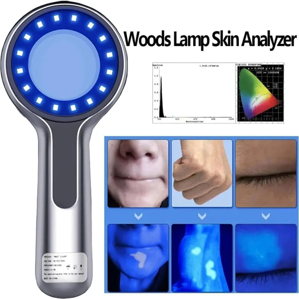 Woods Lamp Skin Analyzer 16-LED UV 365nm Handheld Magnifier for Facial Skin Analysis & Detection